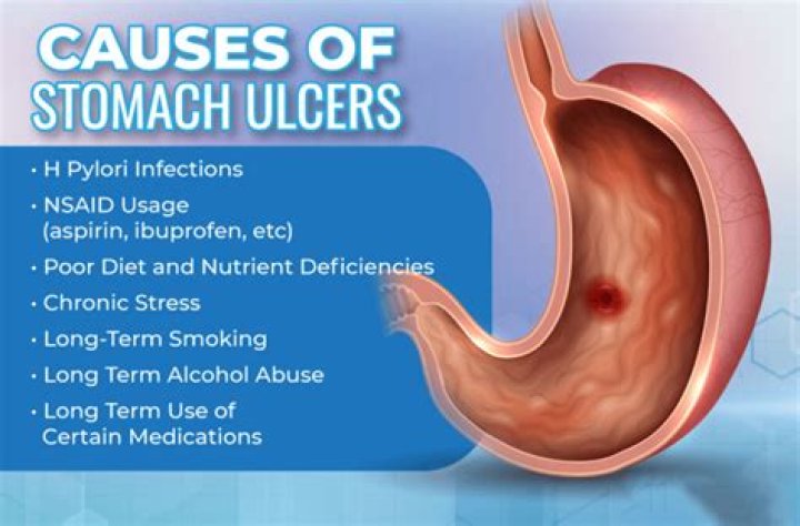 Can pain medication cause ulcers