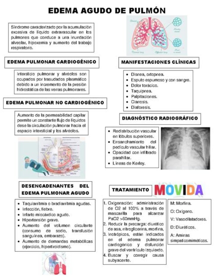 ¿Cómo diagnosticar edema agudo de pulmon