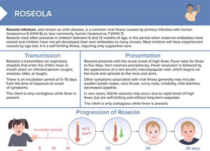 Do you have to have a fever with roseola