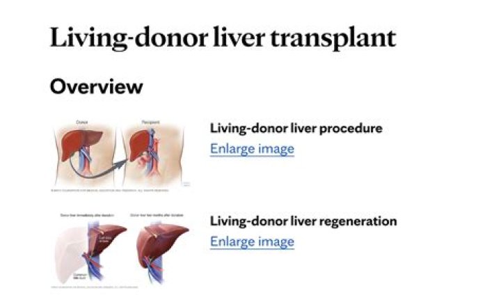 How dangerous is live liver donation