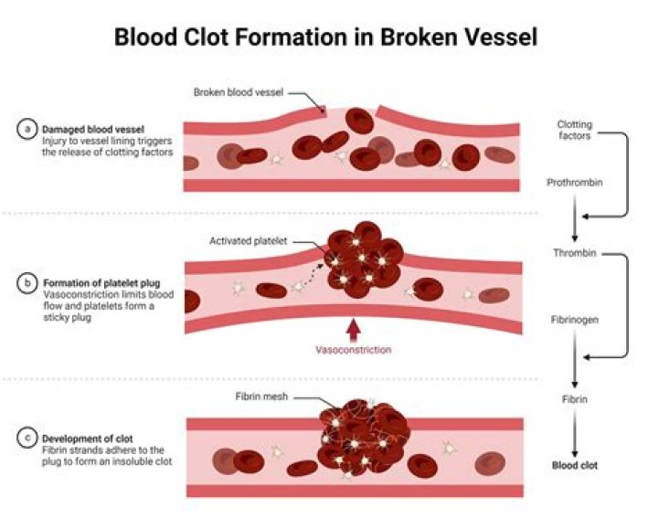 How does a clot dissolve during fibrinolysis