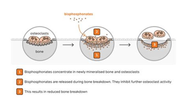 How fast do bisphosphonates work
