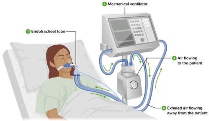 How is ventilator connected