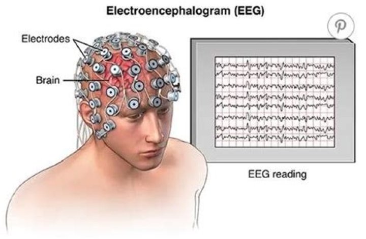 How many electrodes does an EEG have