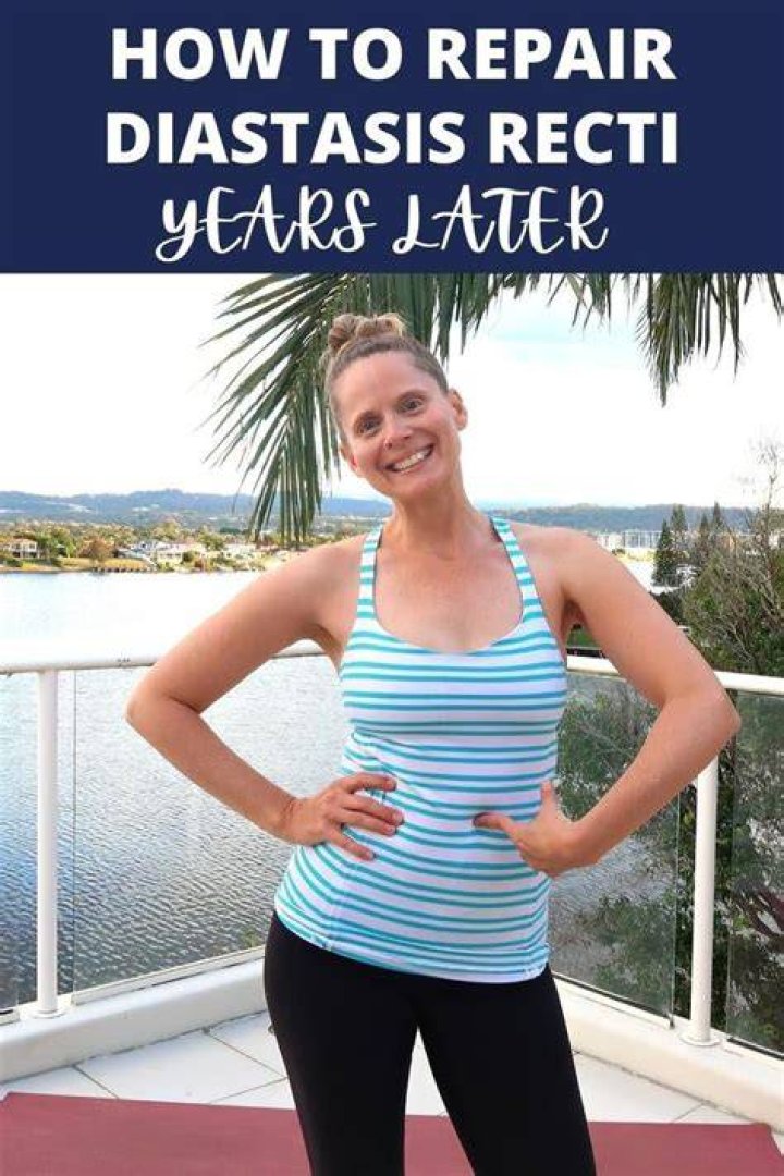 How To Get Medicaid To Pay For Diastasis Recti Repair