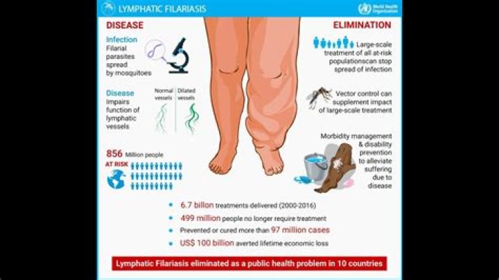 Is elephantiasis caused by virus