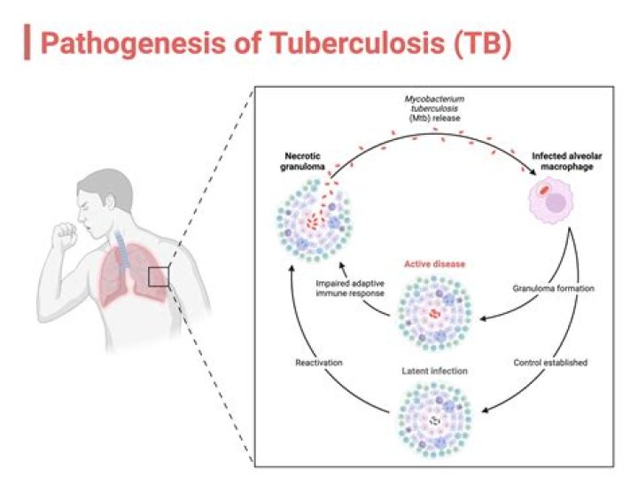 Is ocular tuberculosis curable