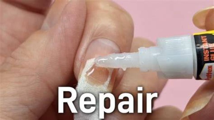 Quick Answer: How To Repair Vertical Split Toenail