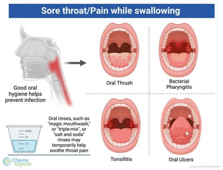 Sore throat from snoring - How To Discuss
