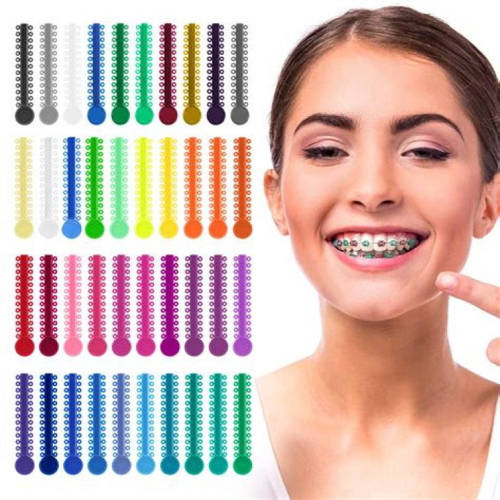 Summer Braces Colors - How To Discuss