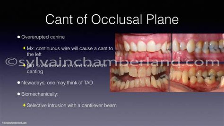 What are occlusal films used for