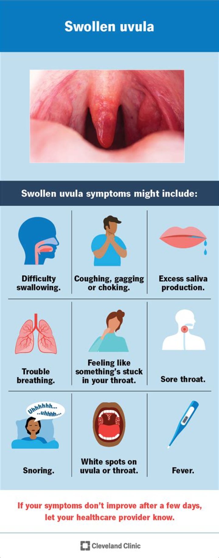What causes a split uvula