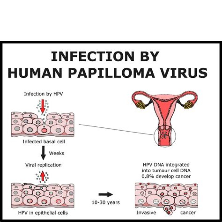 What condition does human papillomavirus cause quizlet