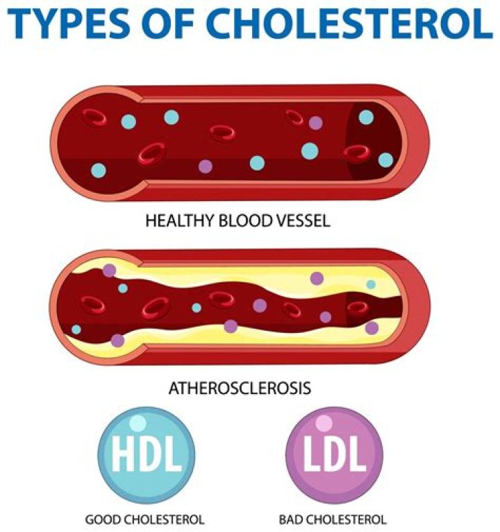 What does it mean when your bad cholesterol is low