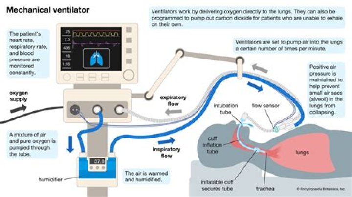 What does peak mean on a ventilator
