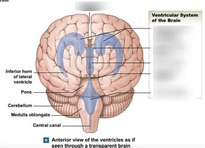 What happens if the interventricular foramen is blocked