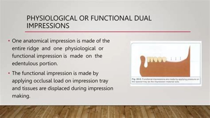 What is a functional impression