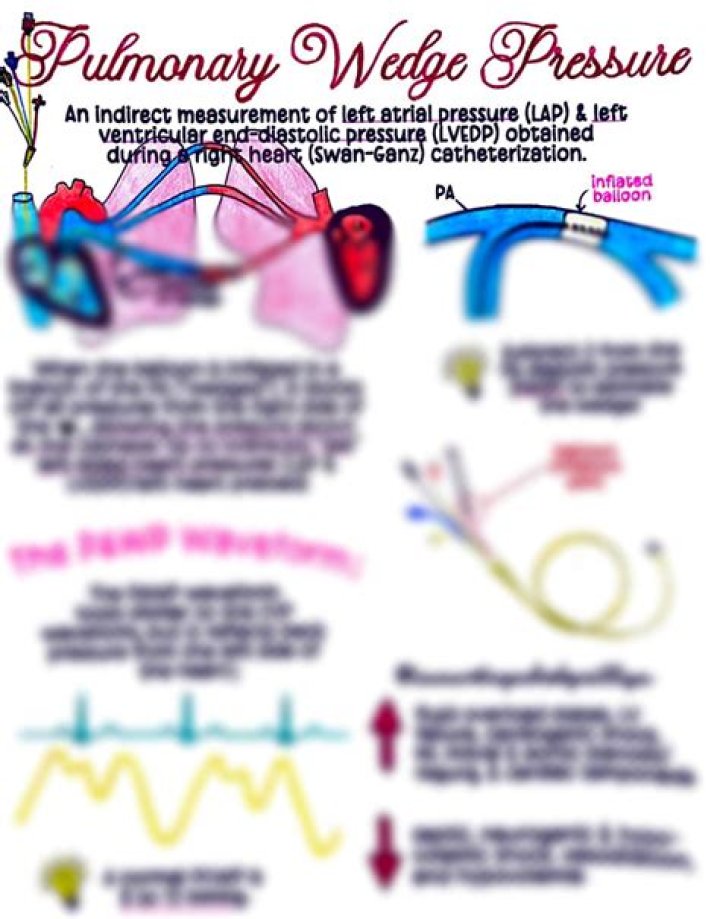 What is a normal pulmonary wedge pressure