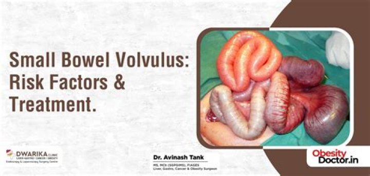 What is a volvulus medical term