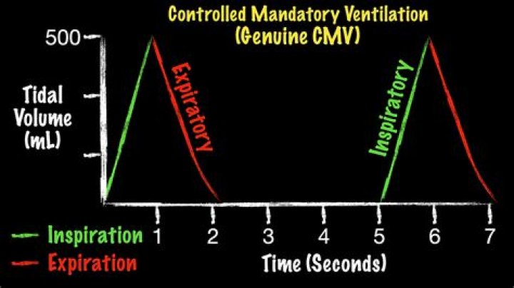 What is the difference between PRVC and Simv