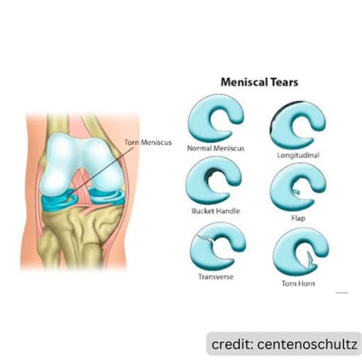 What is the meniscus used for
