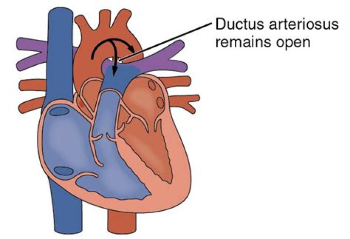 What is the remnant of the ductus arteriosus called