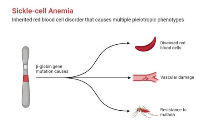 What is the scientific name for sickle cell anemia