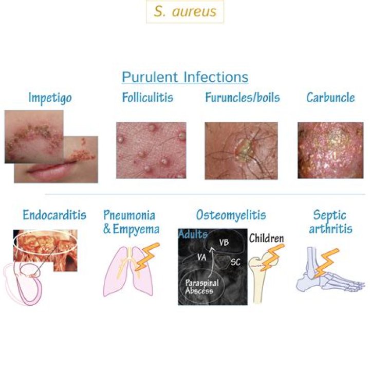 What skin lesions are usually caused by Staphylococcus aureus