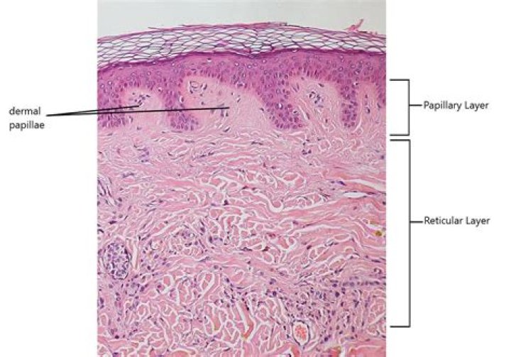 What type of tissue is the reticular layer