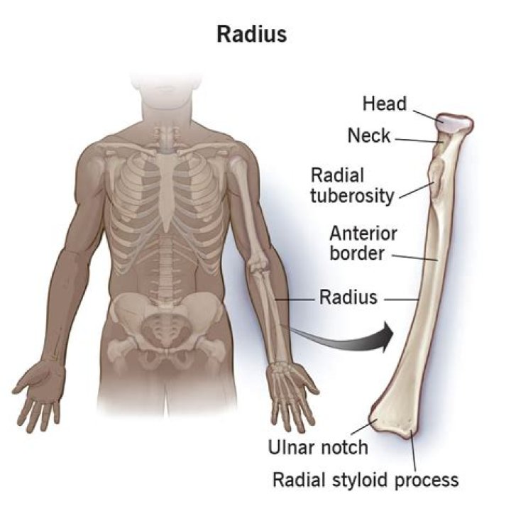 Where is radial engine used